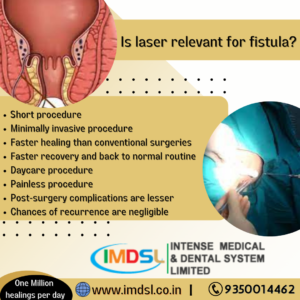 Proctology Laser for fistula