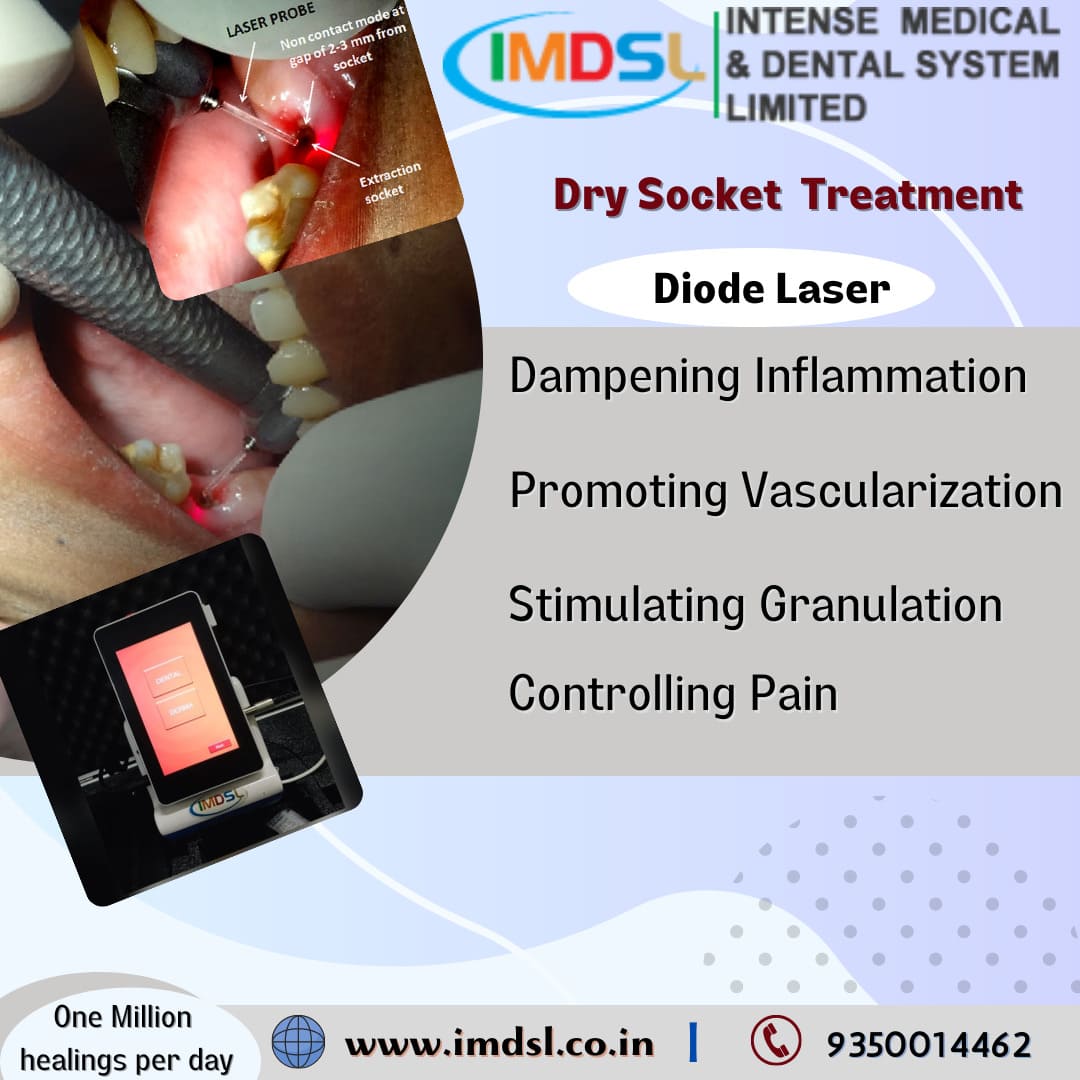 Dry Socket Therapy by IMDSL Dental Diode Laser