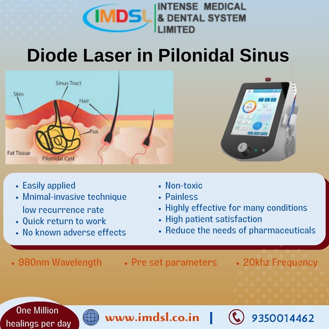Treating Pilonidal Sinus with Surgical Laser: A Modern Solution for a Persistent Problem
